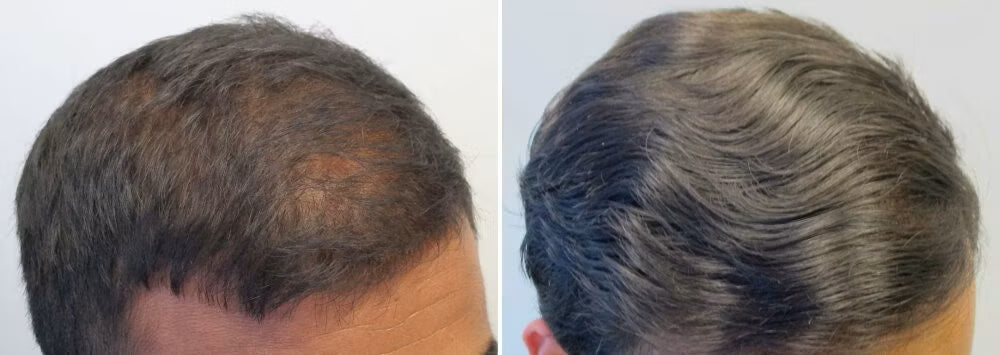 Customer before and after photo