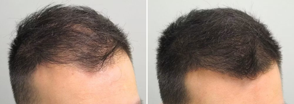 Customer before and after photo