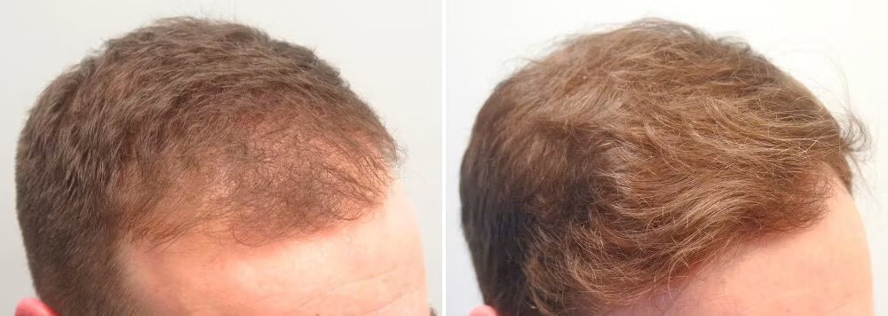 Customer before and after photo