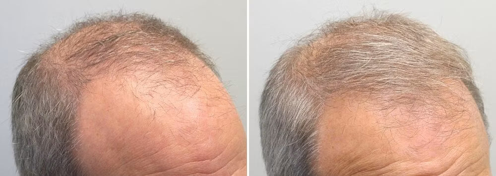 Customer before and after photo