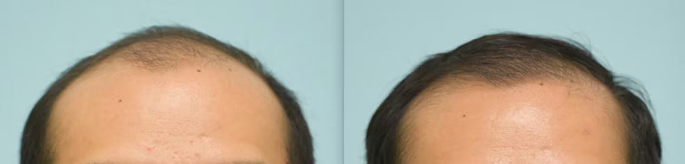 Customer before and after photo