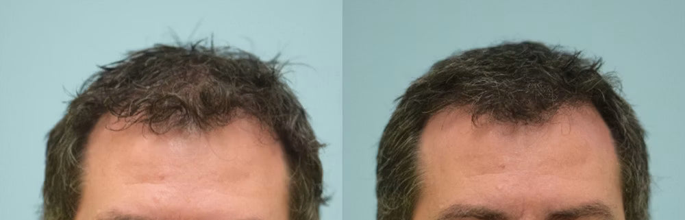 Customer before and after photo