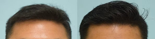 Customer before and after photo