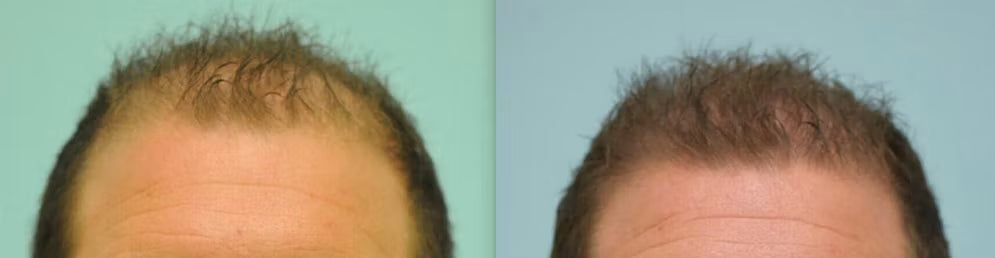 Customer before and after photo