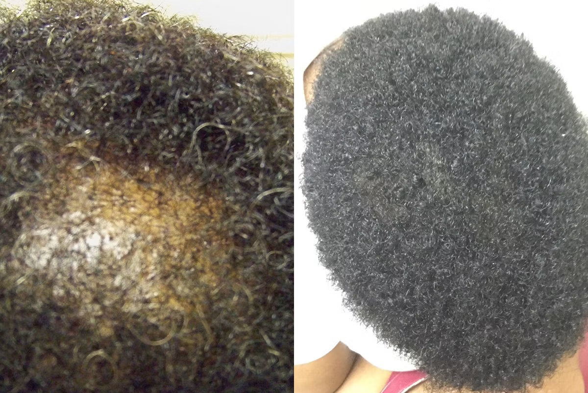 Customer before and after photo