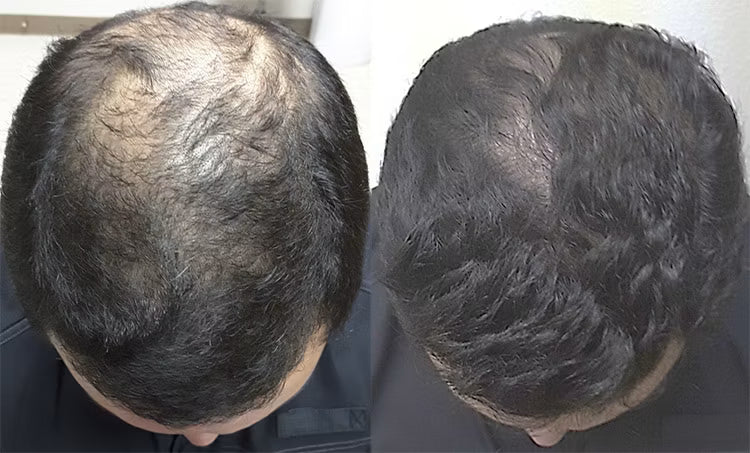 Customer before and after photo