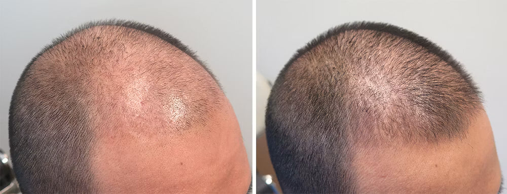 Customer before and after photo