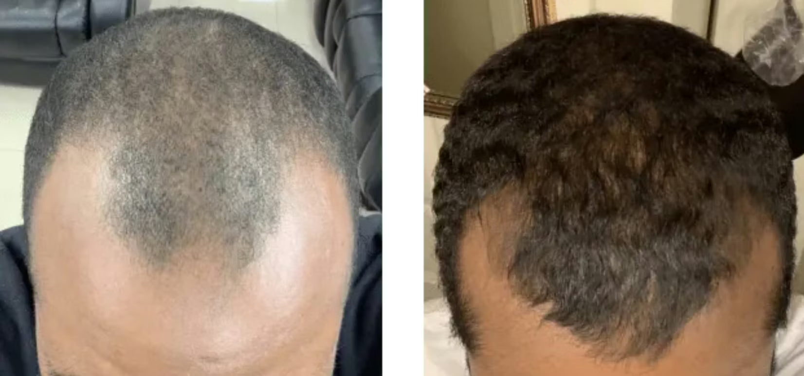Customer before and after photo
