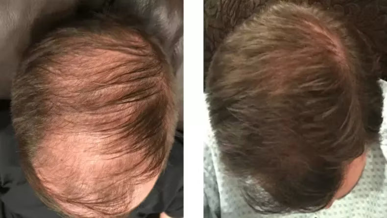 Customer before and after photo