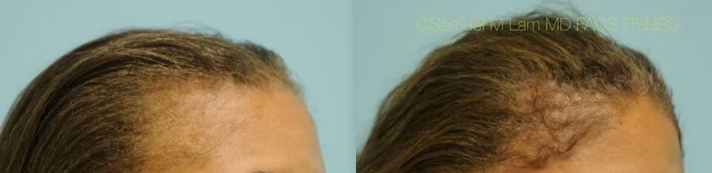 Customer before and after photo