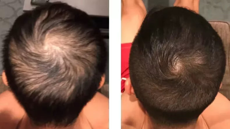 Customer before and after photo