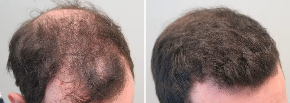 Customer before and after photo