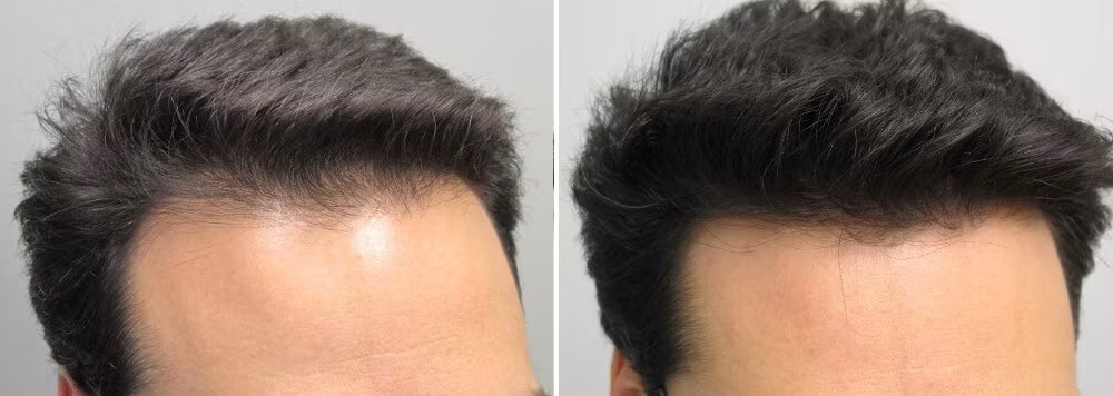Customer before and after photo